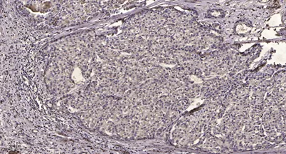 PDGF Receptor β (phospho-Tyr1009) rabbit pAb - image 1