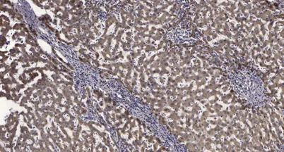 SLP-76 (phospho-Tyr145) rabbit pAb - image 1