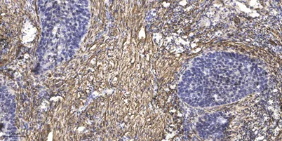 ATG13 Rabbit rabbit pAb - image 1