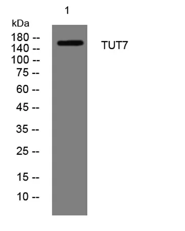 TUT7 rabbit pAb