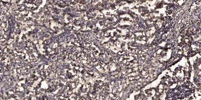 SLP-76 (phospho-Ser376) rabbit pAb - image 1