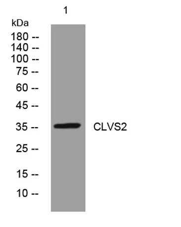 CLVS2 rabbit pAb - image 1