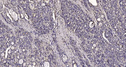 FKBP1A/B rabbit pAb
