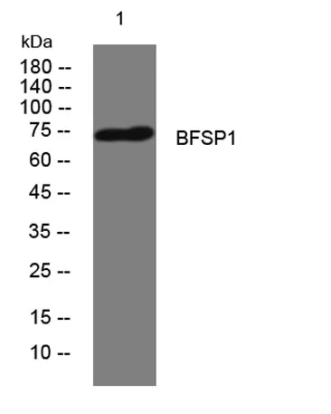 BFSP1 rabbit pAb - image 1