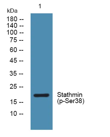 Stathmin (phospho-Ser38) rabbit pAb - image 1