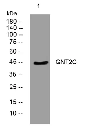 GNT2C rabbit pAb