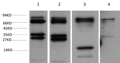 SGT1/ECD Rabbit pAb - image 1