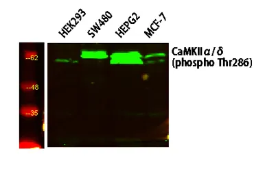 CaMK2 (Phospho-Thr286) Rabbit pAb - image 1