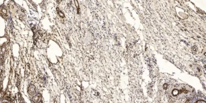 Phospho PKC θ (Y90) rabbit pAb - image 1