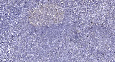 Progesterone Receptor (phospho-Ser345) rabbit pAb