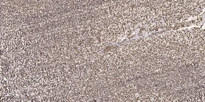 MOK (Phospho-Tyr161) rabbit pAb
