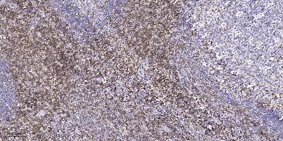 FLNC rabbit pAb - image 1