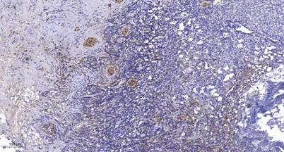 PRK1 (phospho-Thr774)/PRK2 (phospho-Thr816) rabbit pAb - image 1