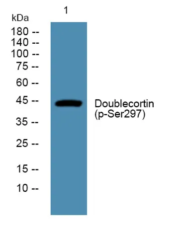Doublecortin (phospho-Ser297) rabbit pAb - image 1