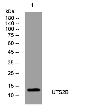 UTS2B rabbit pAb - image 1