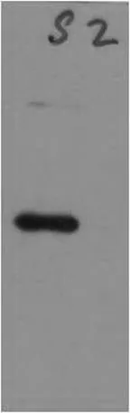 SARS-COV-2 Spike Protein S2 Rabbit pAb - image 1