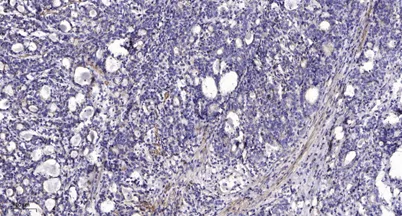 LAT (Phospho Tyr255) rabbit pAb - image 1