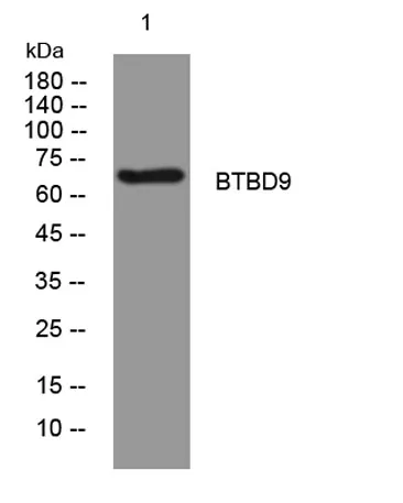 BTBD9 rabbit pAb - image 1