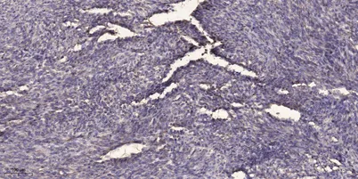 SQSTM1/p62 (phospho-Ser403) rabbit pAb - image 1