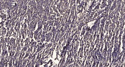 PKCα/β II (phospho-Thr638/641) rabbit pAb - image 1