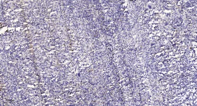 LATS1 (phospho-Thr1079) rabbit pAb