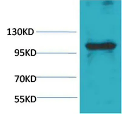 eEF1A2 binding protein rabbit pAb - image 1