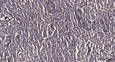 Stat3 (Acetyl-Lys49) rabbit pAb