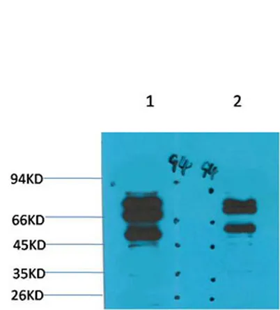 GABA A Receptor γ2 rabbit pAb - image 1