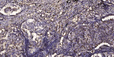 Smad7 (Acetyl Lys70) rabbit pAb - image 1