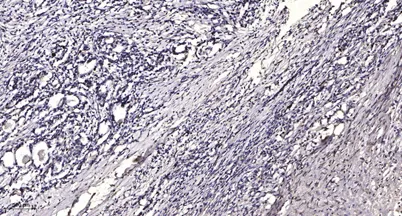 LRP6 (phospho-Ser1490) rabbit pAb
