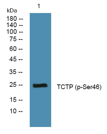 TCTP (phospho-Ser46) rabbit pAb - image 1