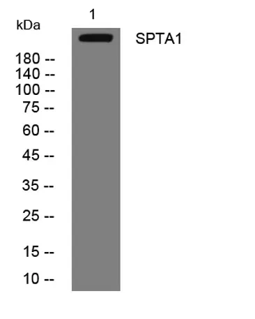 SPTA1 rabbit pAb