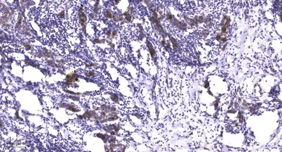 LATS1/2 (phospho-Ser909) rabbit pAb