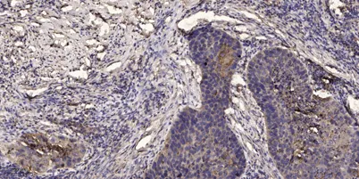 Jak3 (phospho-Tyr980/981) rabbit pAb - image 1