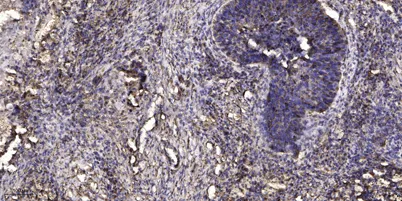 LCP1 (phospho-Tyr28) rabbit pAb - image 1