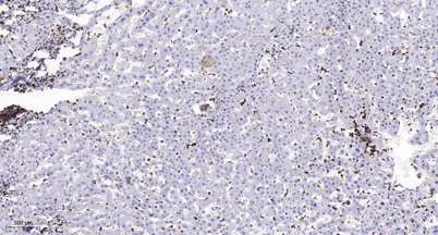 MMP1 (Cleaved-Ile271) rabbit pAb - image 1