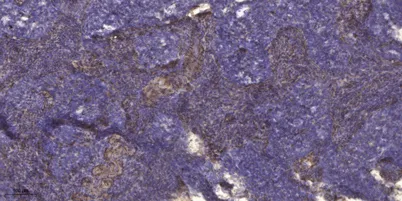 Kallikrein-4 (Cleaved-Ile31) rabbit pAb - image 1