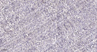 ITGA6 (heavy chain, Cleaved-Arg938) rabbit pAb - image 1