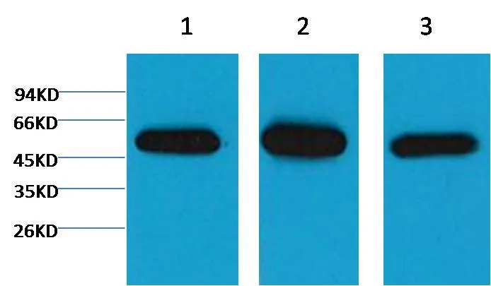 β I tubulin Mouse mAb