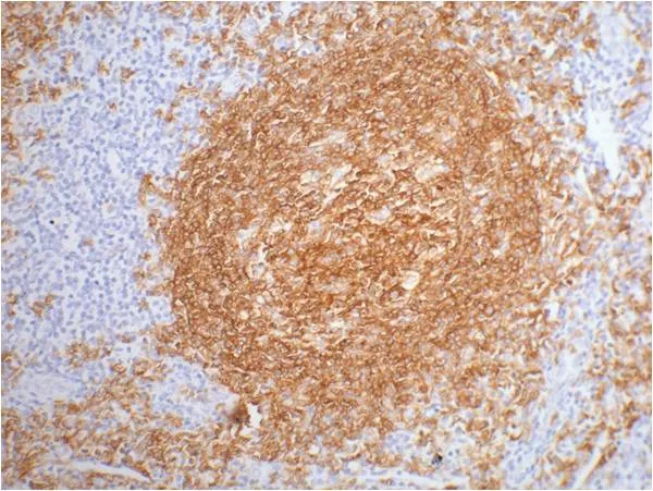 CD20 Mouse mAb - image 1