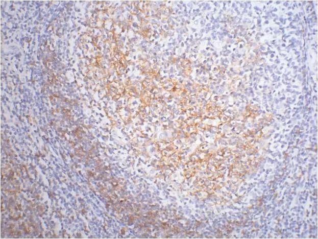 CD23 Mouse mAb - image 1