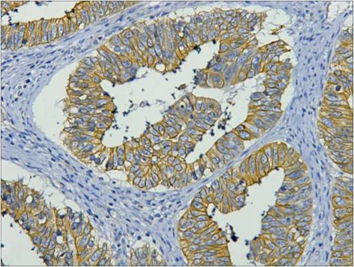 CK19 Mouse mAb