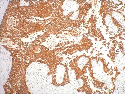 CK16 Mouse mAb
