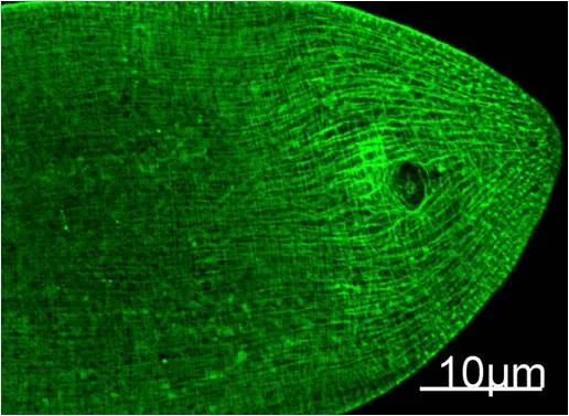 Myosin Heavy Chain Mouse mAb