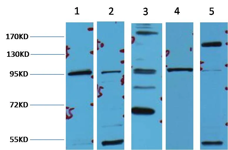 β-Catenin Mouse mAb