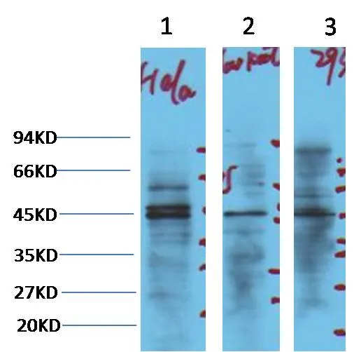 NSE Mouse mAb