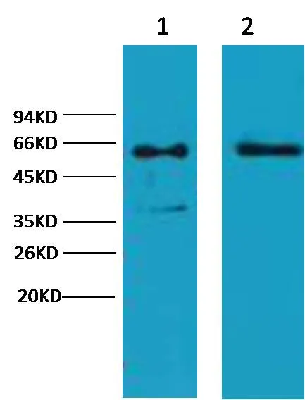 Cytokeratin 6 Mouse mAb