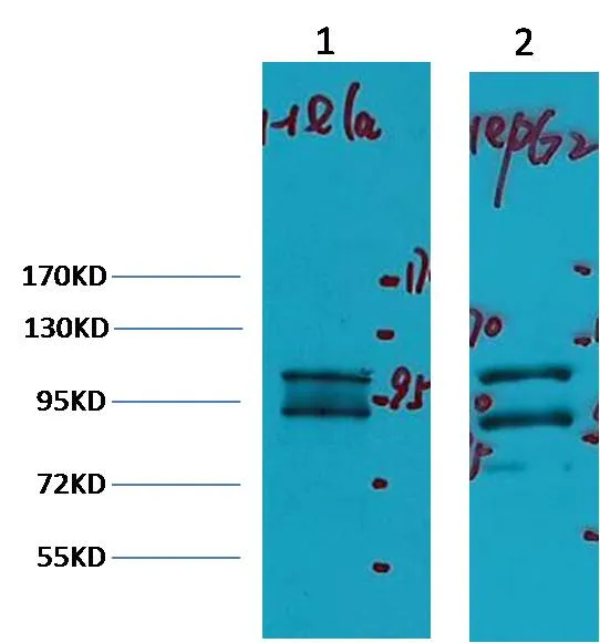 IDE/Insulin Degrading Enzyme Mouse mAb - image 1