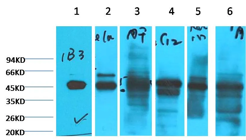Cytokeratin 18 Mouse mAb