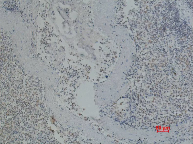 CD41/Integrin α/2b Mouse mAb - image 1